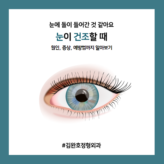  눈이 건조할 때, 눈에 돌이 들어간 것 같아요
