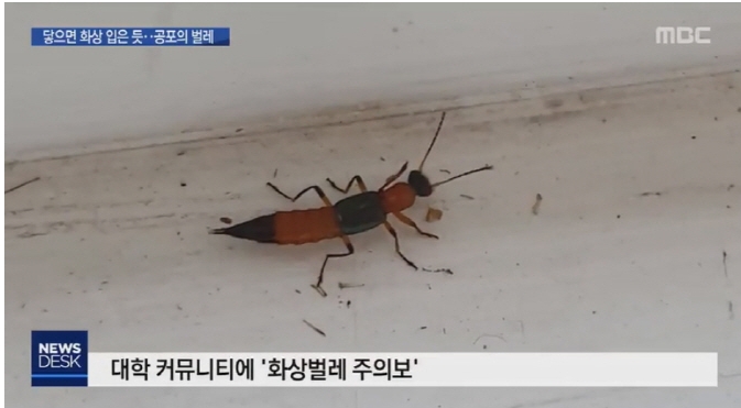  닿기만 해도 상처…대학 기숙사 덮친 동남아 '화상 벌레.