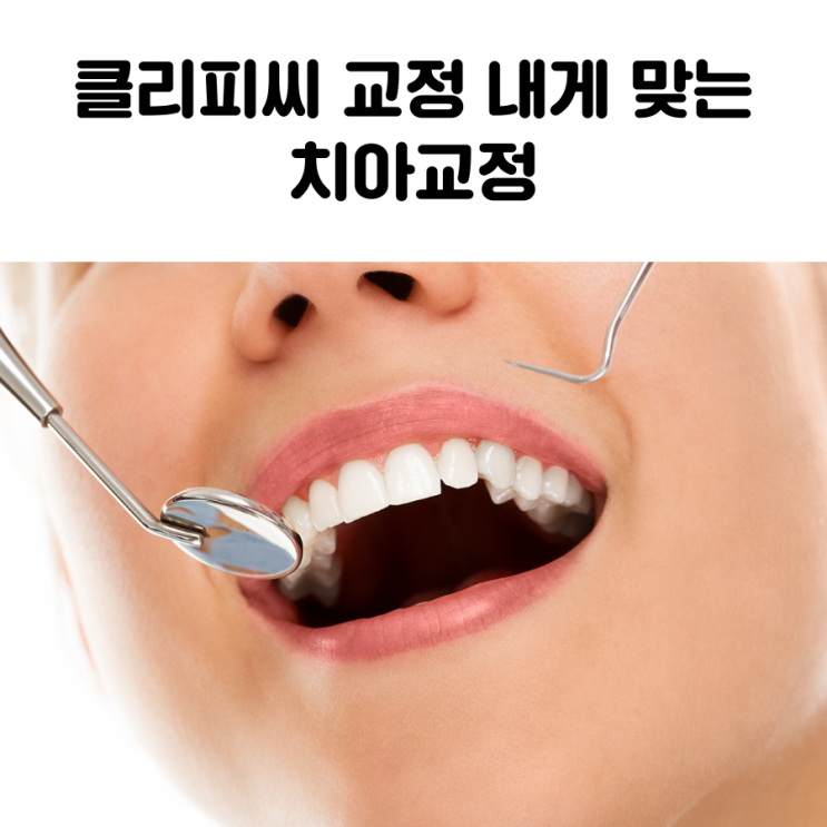  혜화 교정치과 클리피씨 교정 내게 맞는 치아교정