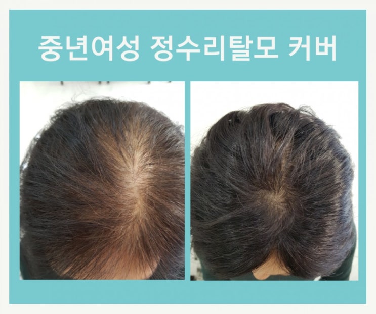  천안가발 속 보이지 않는 여자 그녀는 아름답다