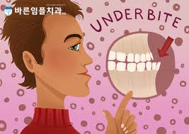  중장년치아교정 치료 해도 되는걸까요?