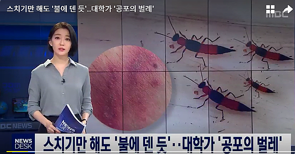  [공포의 화상벌레] 대학가 "공포의 벌레" 스치기만 해도 불에 덴 듯 화상