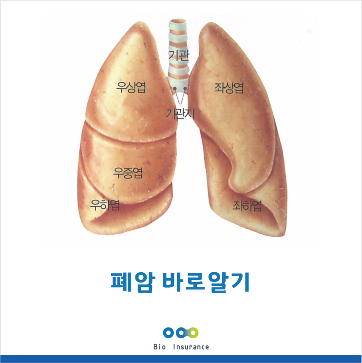  폐암 증세 바로알기