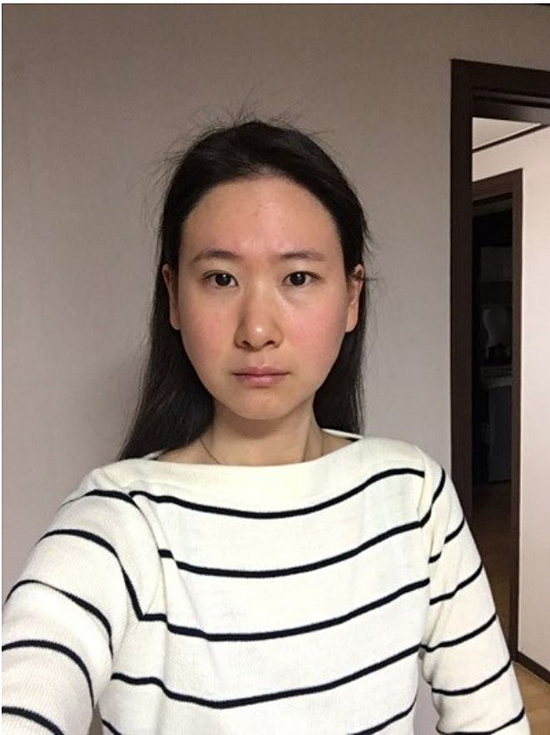  민트실리프팅후기 만족시키는 방법