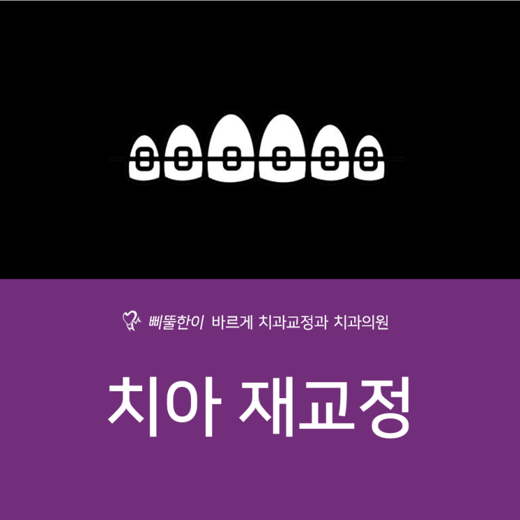  [대연동 교정치과] 치아 재교정 치료