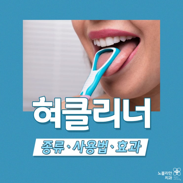  혀클리너 종류ㆍ사용법ㆍ효과? 입냄새 원인 제거하기!