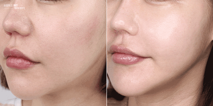 얼굴 붓기 빼는법 효과100%, 2가지 활용법