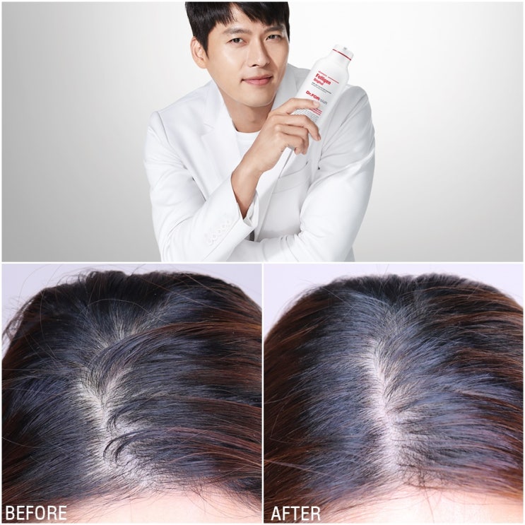  두피케어 닥터포헤어 현빈샴푸로 상쾌하게