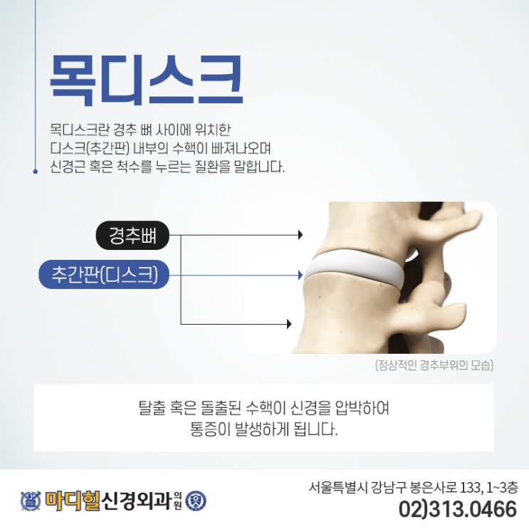  목디스크검사 아직도 받지 않고 계신가요?