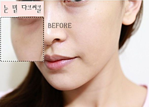  눈밑 다크서클 화이트닝 마스크팩? 따가움 없는 세럼써요