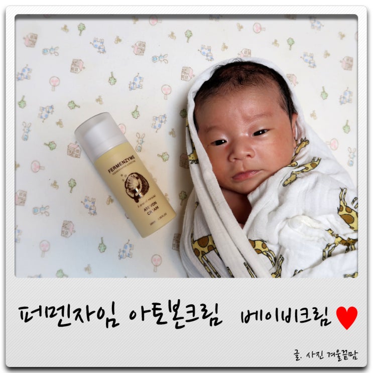 베이비크림 퍼멘자임 아토본크림으로 아기태열 가라앉혀요 베이비크림 퍼멘자임 아토본크림으로 아기태열 가라앉혀요