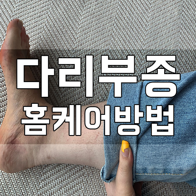  다리부종원인 찾아보고 케어해본 후기