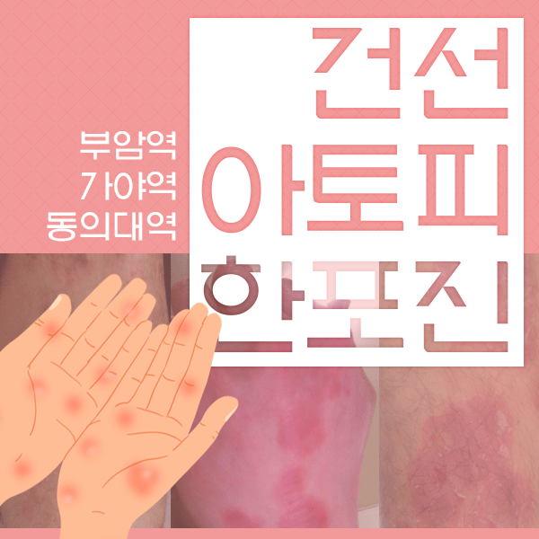  소아한의원 어린이아토피 장건강,면역력기르는 한방오일