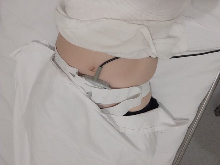  임신 21-25주:: 자궁경부길이 짧아짐 / 첫째 임당은 둘째도 임당?