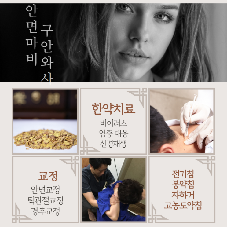  안면신경마비 치료는 시작과 끝이 있습니다