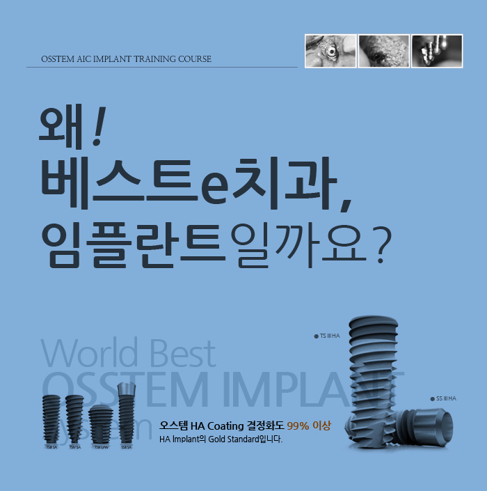  금천구임플란트 또 한번 생각해 본다면!!!