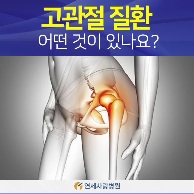  고관절 질환 어떤 것이 있나요?