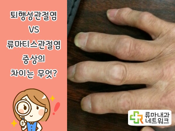 관절염 증상, 원인과 퇴행성관절염 vs 류마티스관절염 비교 / 관절염에 좋은 음식, 관절염 영양제 추천! 5