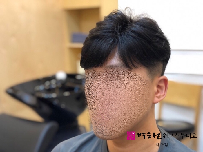  자연스러운 연출이 쉽고 편한 맞춤가발! 남자가발도 박승철 가발!