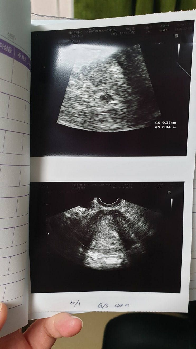  [D-240] 안녕? 쿵떡아, 임신초기증상, 첫째가 동생보면 하는 행동? 믿거나 말거나