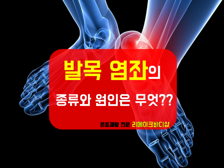  『낙성대 재활』발목 염좌의 원인과 종류에 대해서 알려드립니다!!