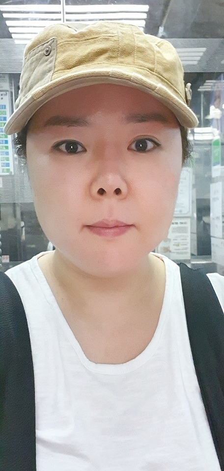  슈링크 300샷 리프팅 한지 일주일 후기