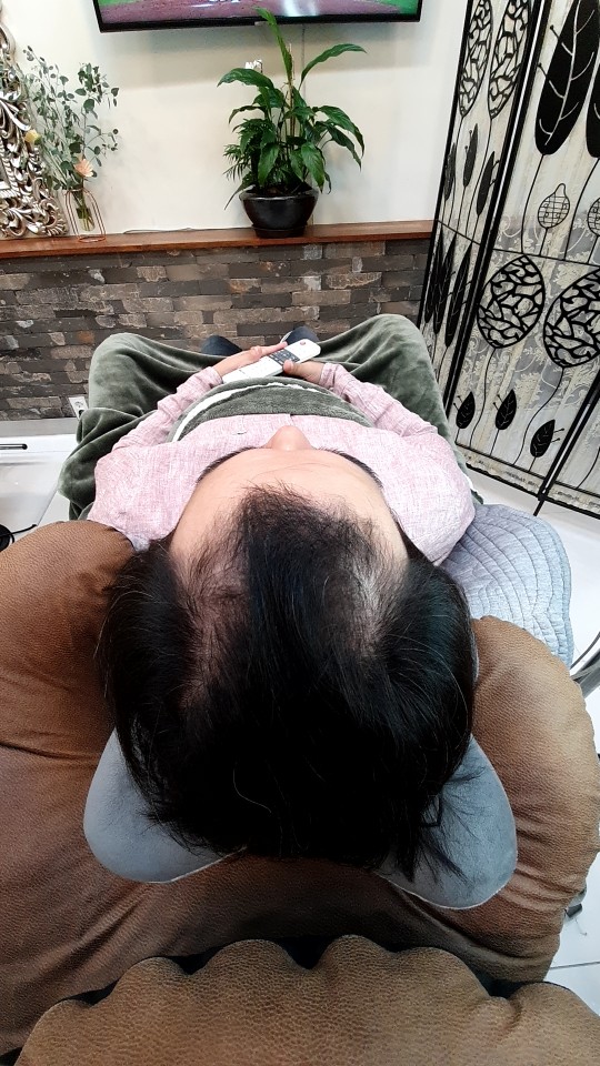 인천증모로 남자붙임머리 완성