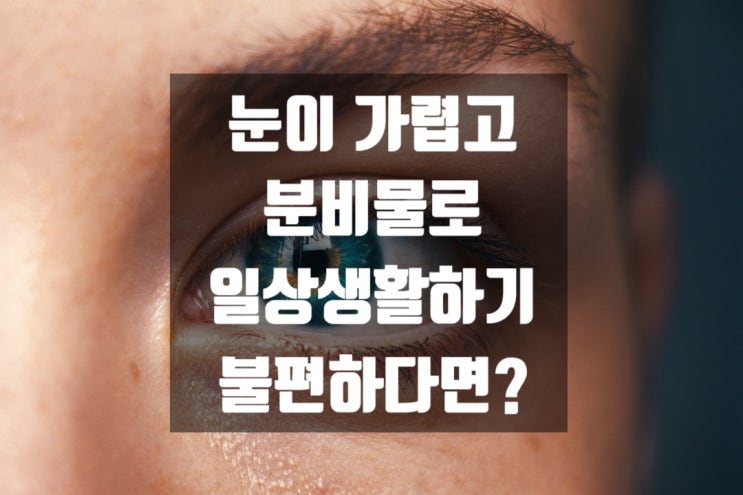  눈이 가렵고 분비물로 일상생활하기 불편하다면?