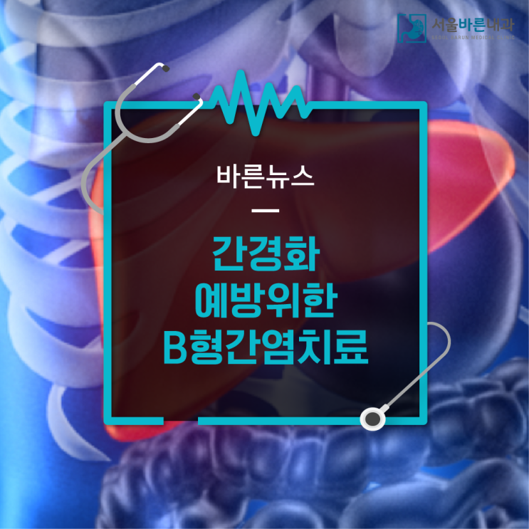  간경화 예방위한 B형간염 치료｜2동탄 소화기내과 서울바른내과