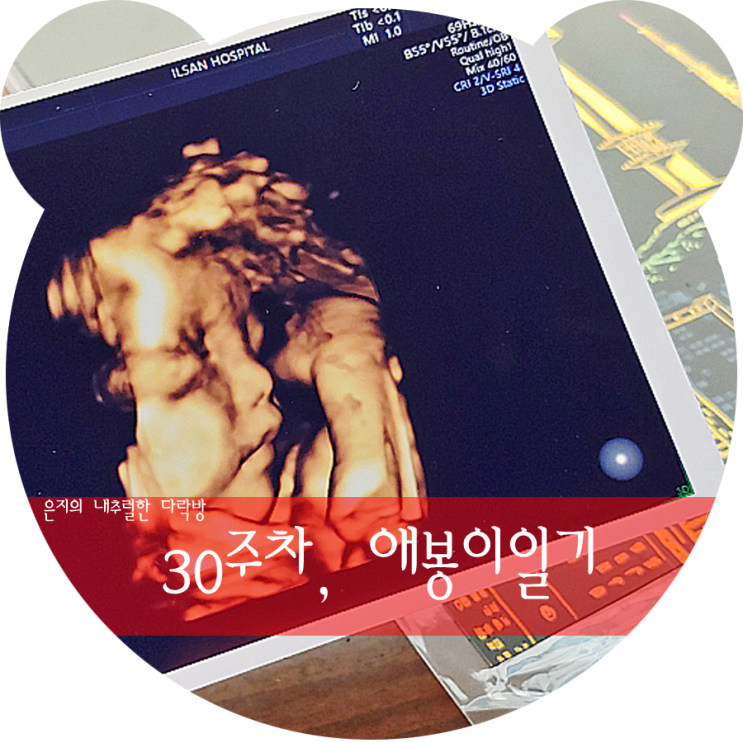  [애봉이 일기] 30주 정기검진, 이것이 튼살!!!!!!!!?