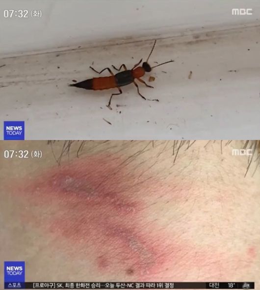  동남아시아 서식 청딱지개미반날개?