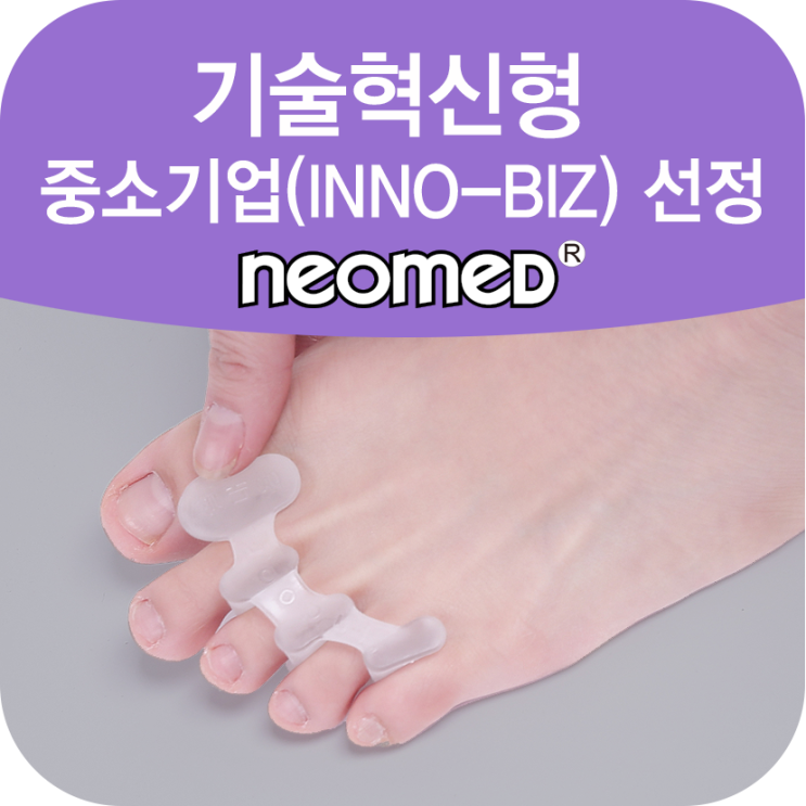  휘고 아픈 엄지발가락, 무지외반증? 발가락 교정기 추천!!