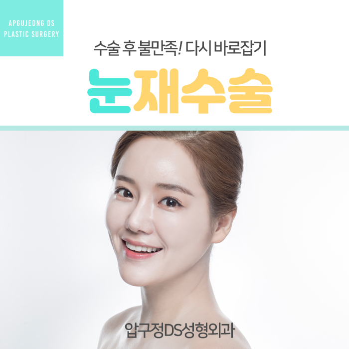  눈재수술, 고민이라면 범계역 눈재수술잘하는곳 압구정DS성형외과