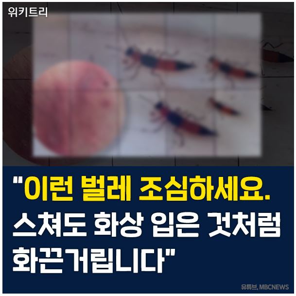  화상벌레 공포, 예방법과 물렸을 때 대처법은?