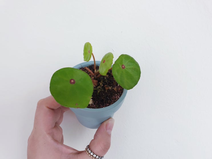  죽고 살고