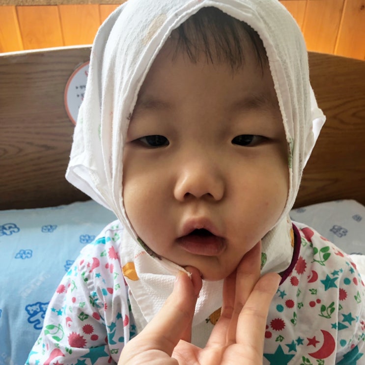  16개월아기 수족구증상, 올것이왔구나