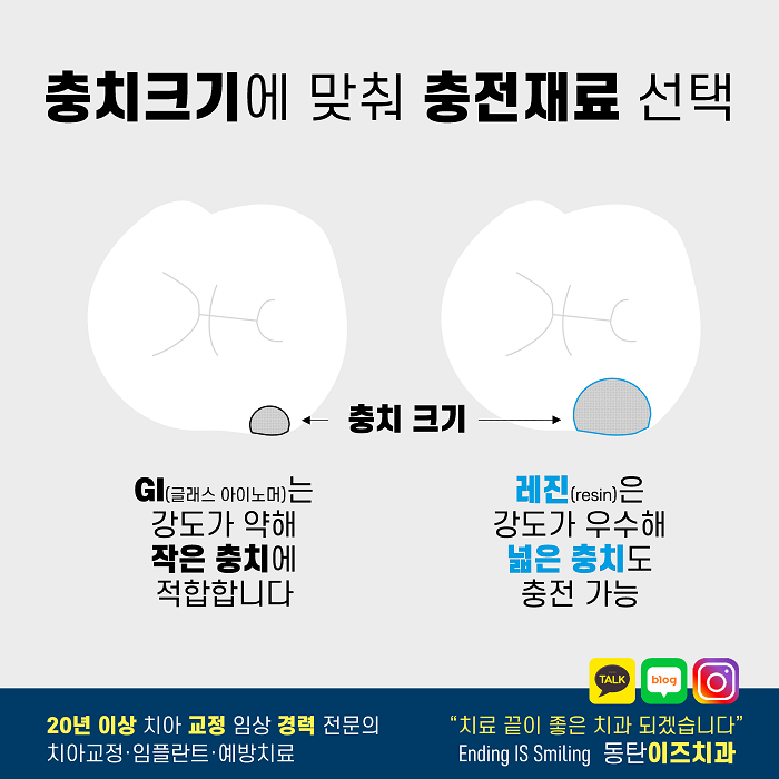  건강보험 혜택 받는 동탄충치치료 -2탄-
