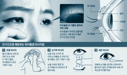  [건강] 눈이 침침해요...ㅠ