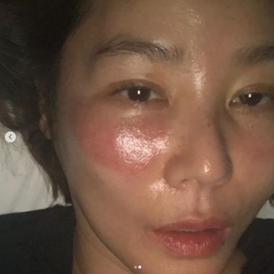  김성령, 충격적인 아이마스크 부작용 공개…"좋은 모습 못보여드려 송구"[SHOT!]