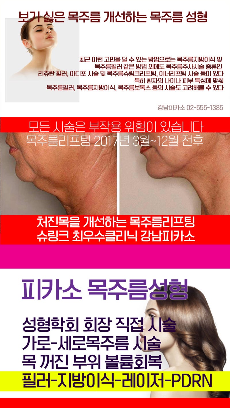 주름관리 이젠 목도 필수! | 목주름 2