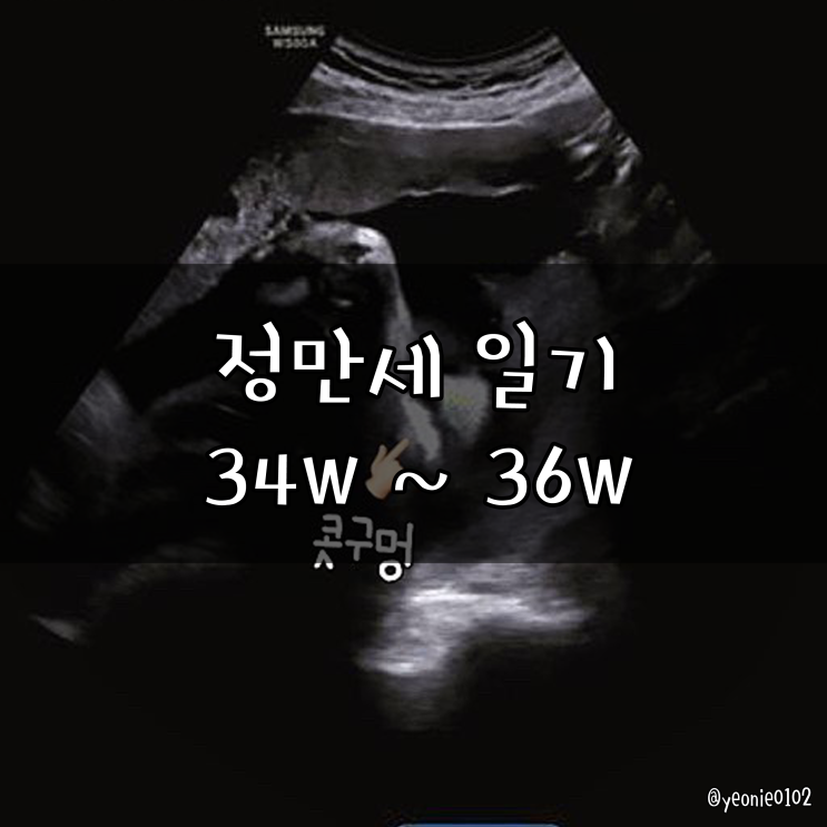  [정만세 일기ღ34주-36주] 34주 초음파 & 36주 막달검사 내진
