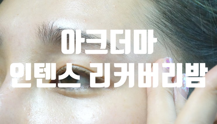  인생크림 아크더마 인텐스 리커버리 밤으로 민감한 피부 여드름에 모공이 늘어난 피부도 관리해요!