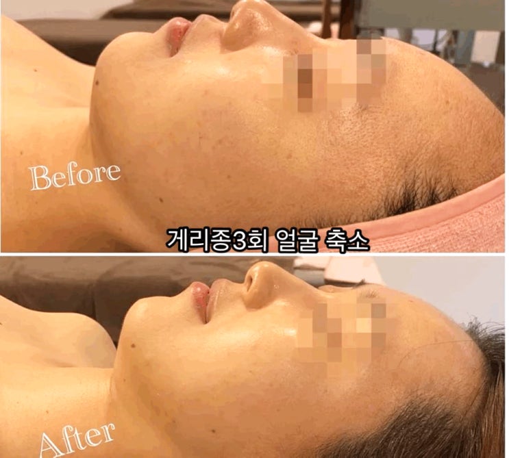  관리할 수 록 빛이나는 피부를 위한 제주시 노형 피부샵 할인정보!