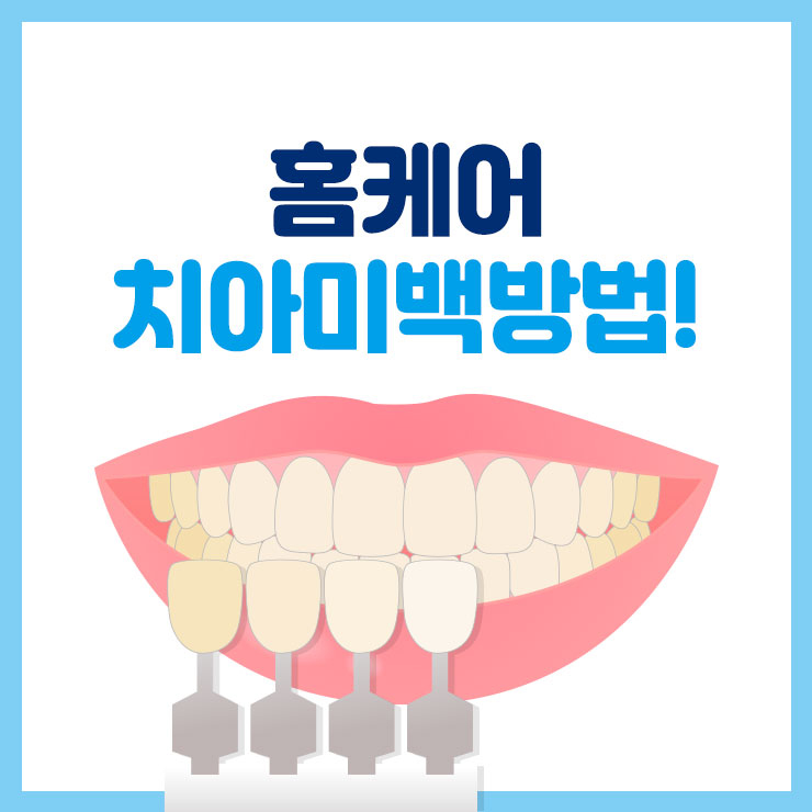  치아미백방법 명동우리치과에서 알려드립니다!