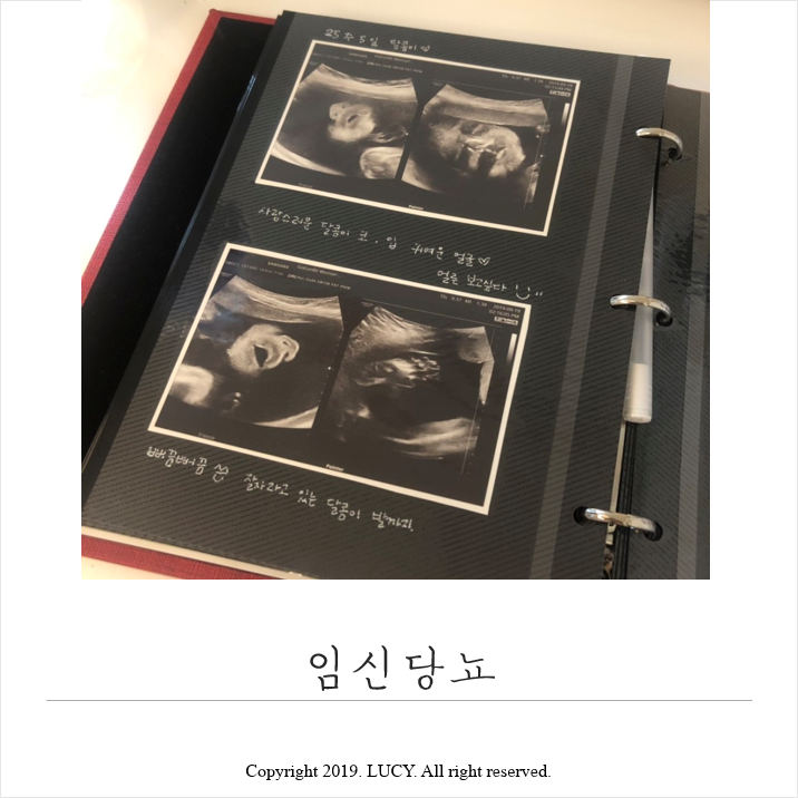  임신 25주 초음파 #임신당뇨 #임산부수영 #태동은 건강의 증거!