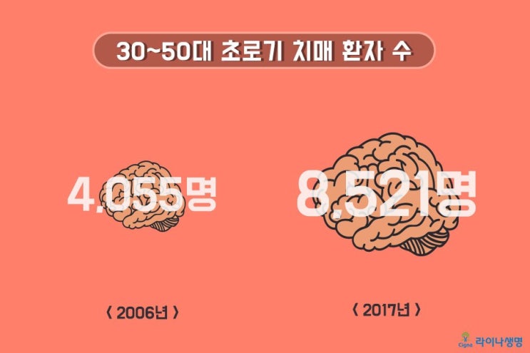  ‘나쁜’ 콜레스테롤 과다, 초로기 치매 원인일 수도