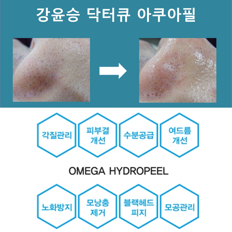  화명동 피부 관리 화명동 아쿠아필 잘하는곳 강윤승닥터큐