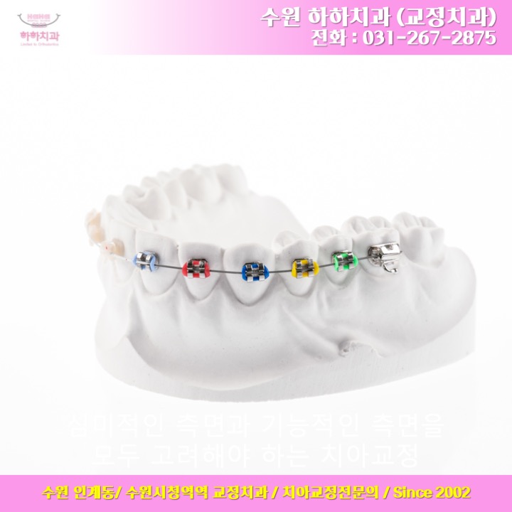  수원치아교정 ] 교정치료의 시작부터 마무리까지 책임지고