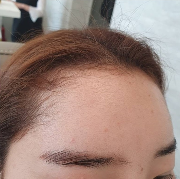  천안왁싱 헤어라인 관리받아봤어요!