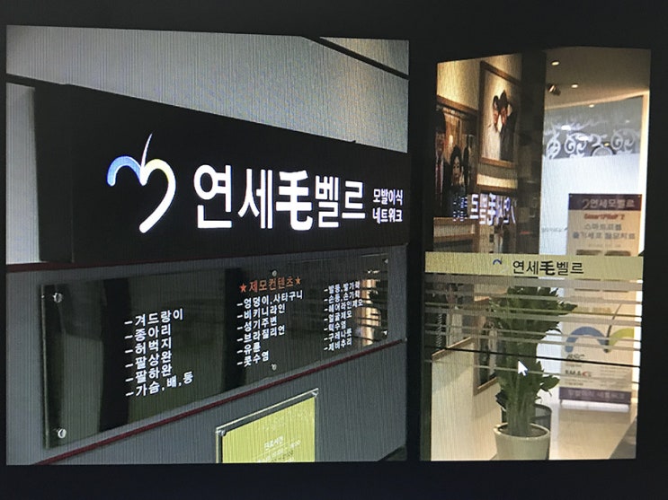  대구탈모 나에게도 생길 수 있는 일입니다.
